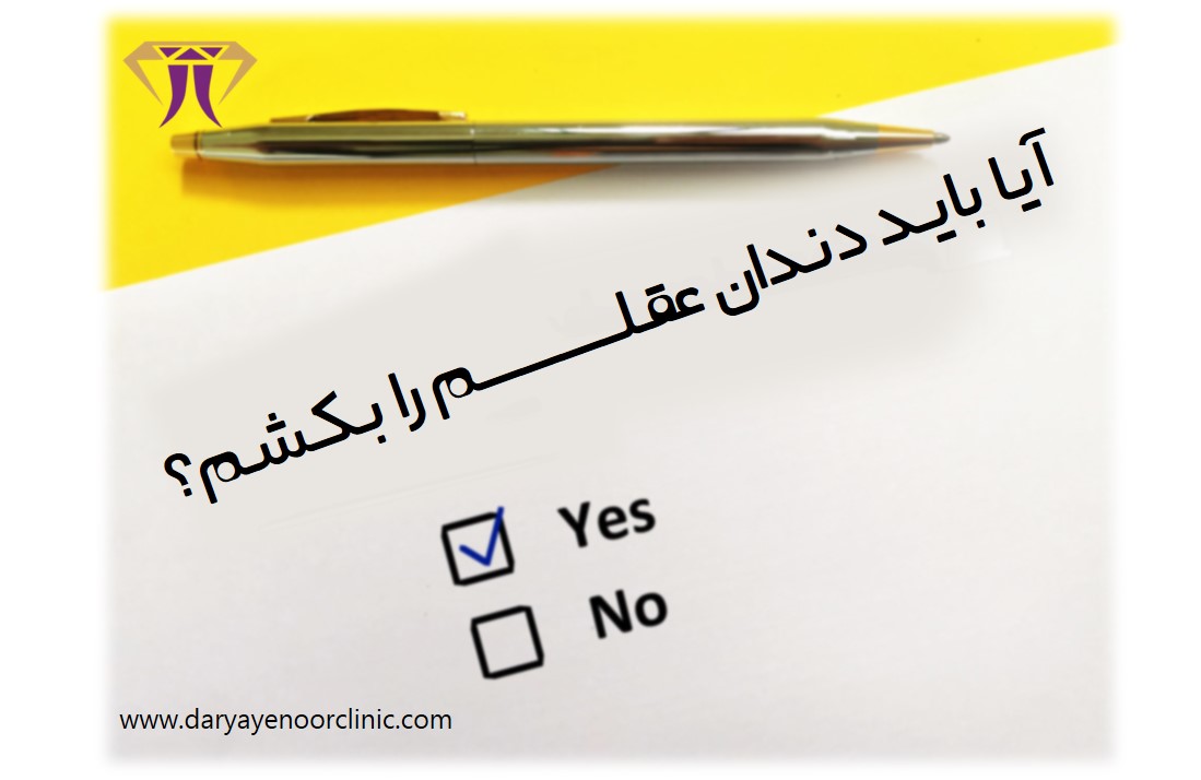 آیا باید دندان عقلم را بکشم؟.jpg آیا باید دندان عقلم را بکشم؟.jpg