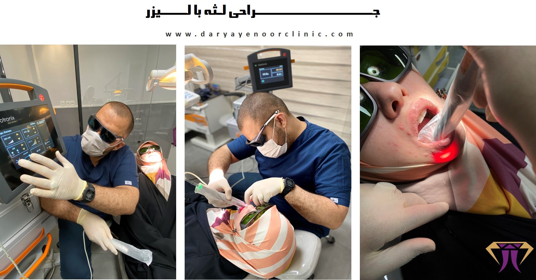 جراحی لثه با لیزر-کلینیک دندانپزشکی دریای نور-min.jpg جراحی لثه با لیزر-کلینیک دندانپزشکی دریای نور-min.jpg