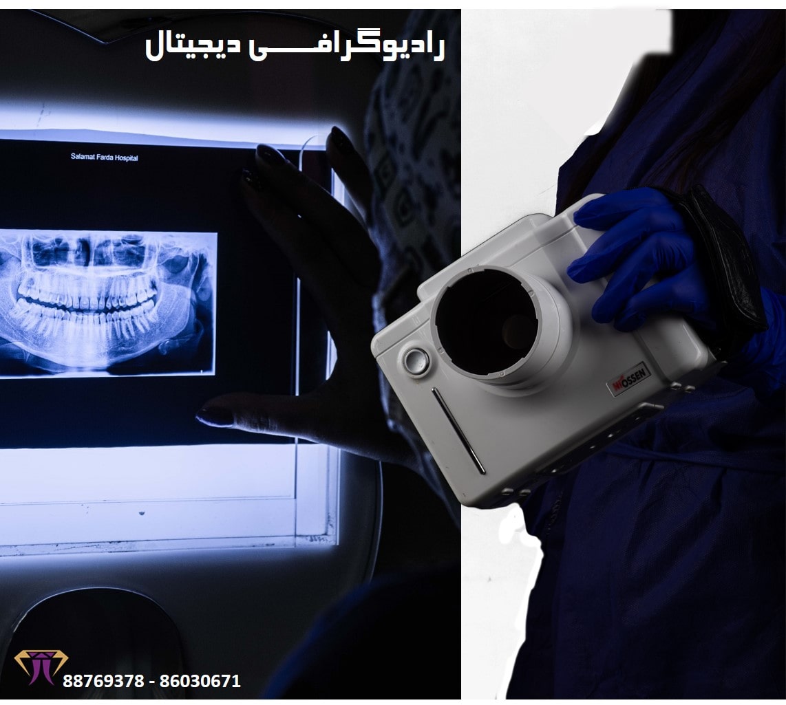 رادیو-گرافی-دیجیتال-کلینیک-دندانپزشکی-دریای-نور-min.jpg رادیو-گرافی-دیجیتال-کلینیک-دندانپزشکی-دریای-نور-min.jpg