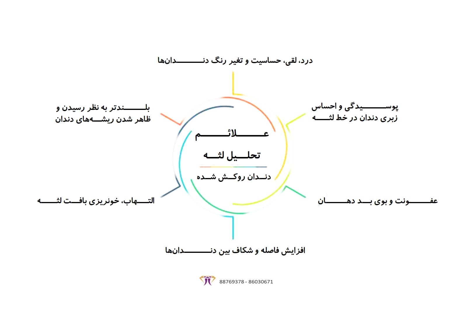 علائم تحلیل لثه دندان روکش شده-min (1).jpg
