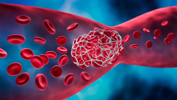 قرص برای رقیق شدن خون.jpg