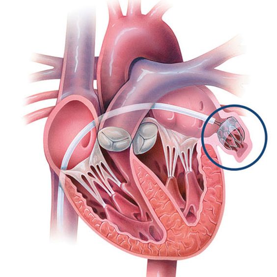 قرص ضد لخته خون.jpg