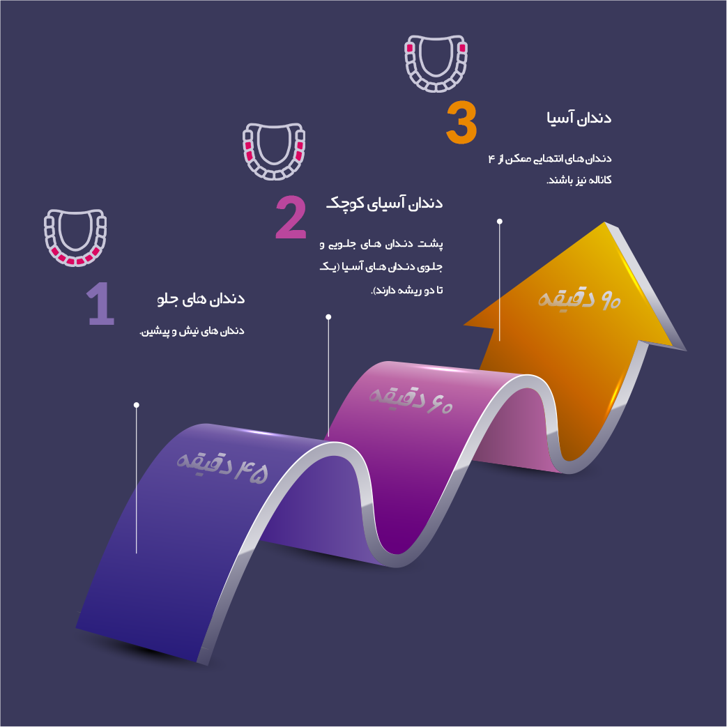 مدت زمان درمان ریشه.png