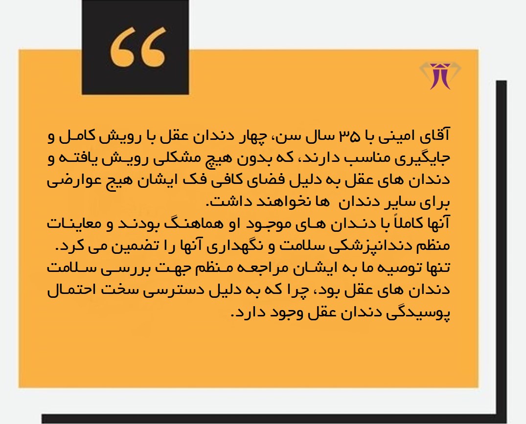 نگهداری- دندان -عقل.jpg