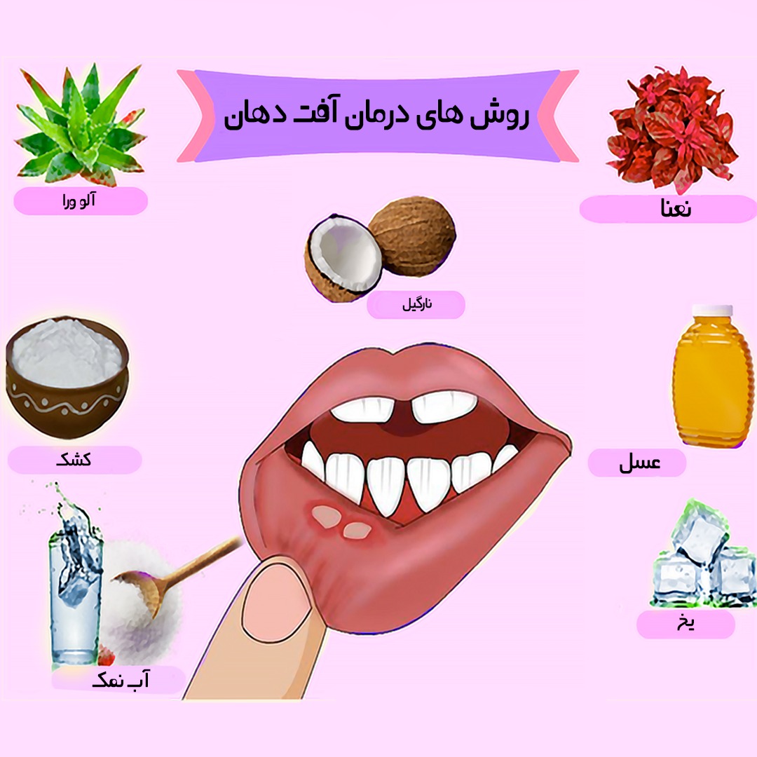 -درمان-خانگی-آقت.jpg