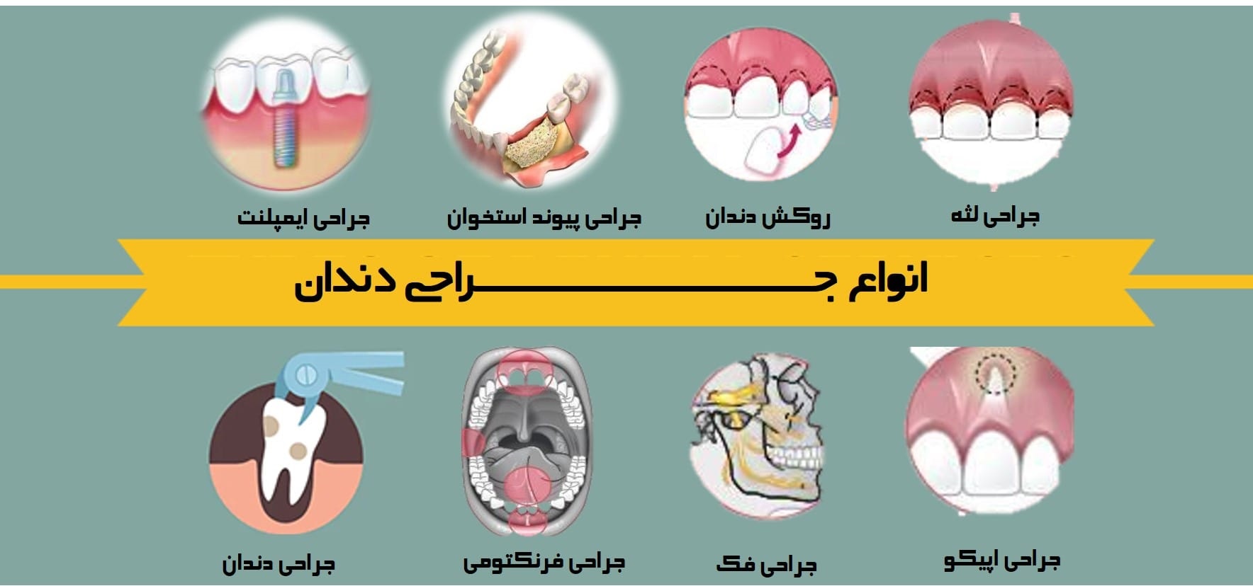 انواع-جراحی-دندان-min.jpg