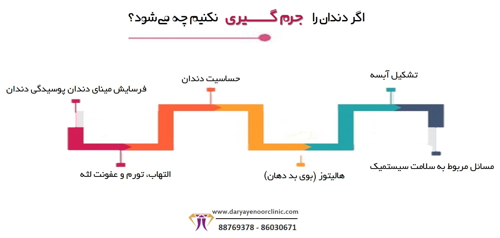 اگر دندان را جرم گیری نکنیم چه می_شود؟-min.jpg اگر دندان را جرم گیری نکنیم چه می_شود؟-min.jpg
