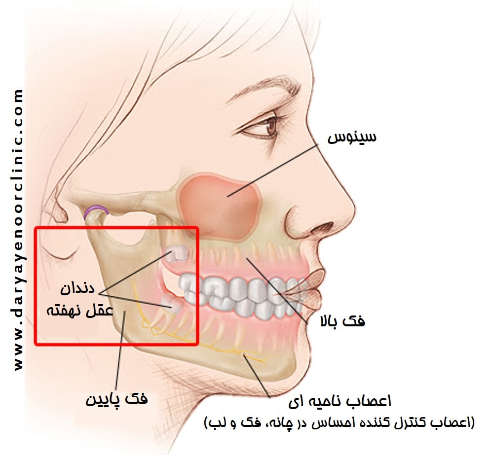 کشیدن دندان سینوسی-min.jpg کشیدن دندان سینوسی-min.jpg