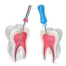 Front Tooth.jpg Front Tooth.jpg